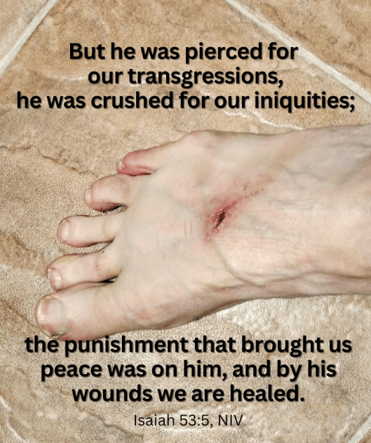 Isaiah 53_5